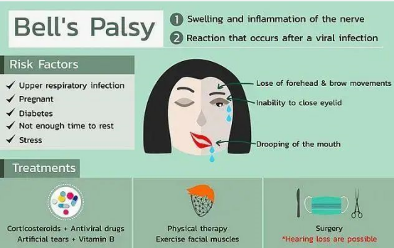 又出事了！4人接種輝瑞疫苗后面癱，還有人頭痛、發(fā)燒、關(guān)節(jié)疼痛！各國(guó)疫苗接種計(jì)劃面臨新風(fēng)險(xiǎn)！